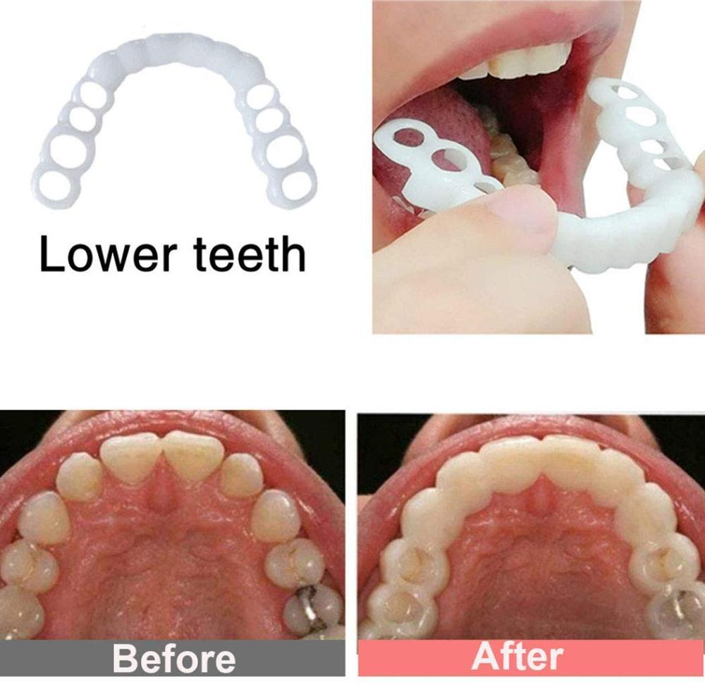 2Pcs Teeth Whitening - MakenShop