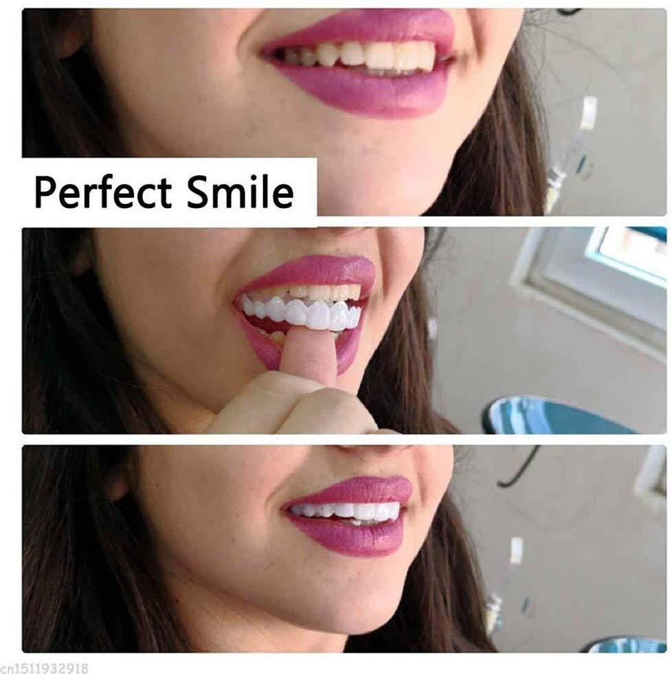 2Pcs Teeth Whitening - MakenShop