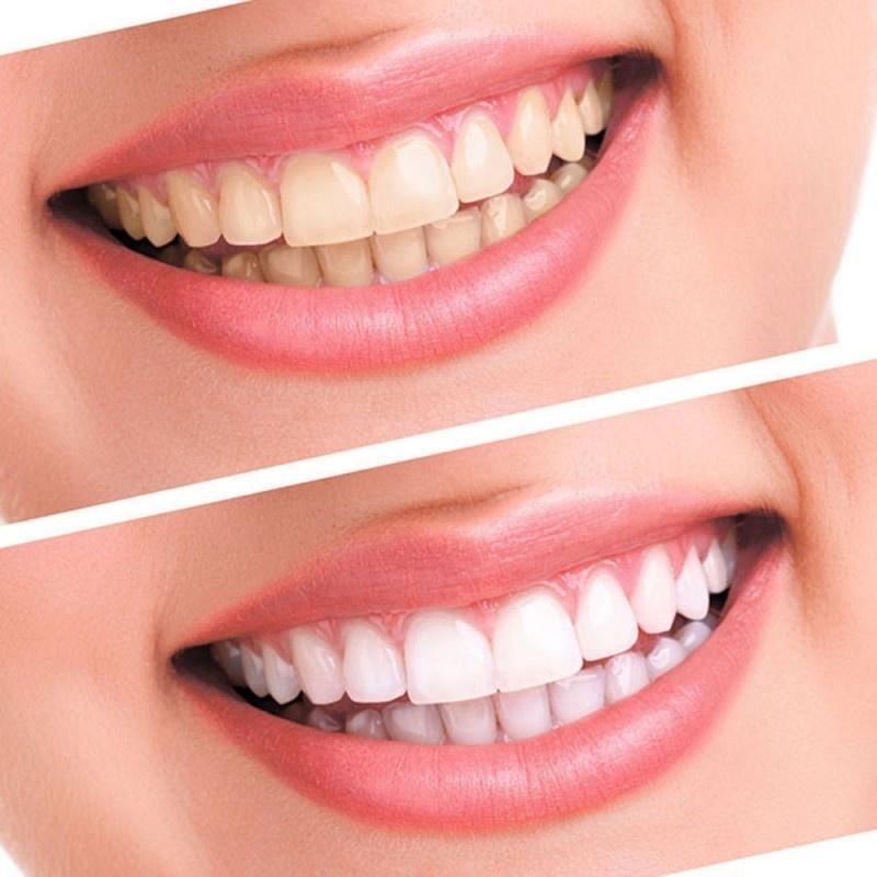 Daily Life Teeth Whitening Strips - MakenShop