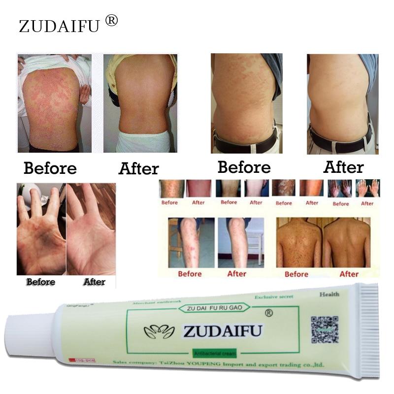 Zudaifu Skin Care Cream Package - MakenShop